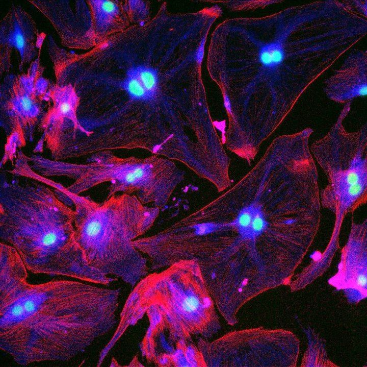 A vivid microscopy image showing brightly colored cells, with red filaments representing the cytoskeleton and blue nuclei at the center of each cell. This image highlights cellular structures and is likely used to study changes in cell morphology or function, such as those related to senescence or disease processes.